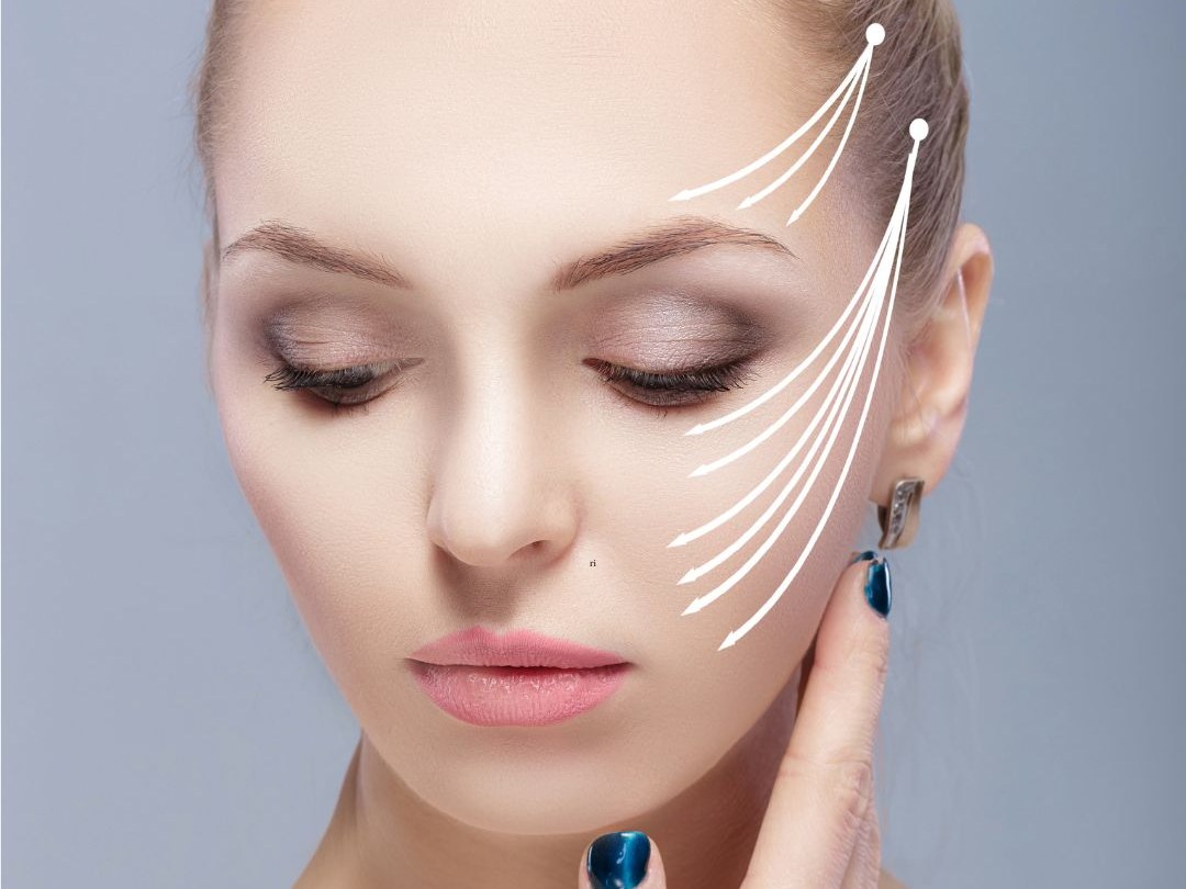Tensado del óvalo facial