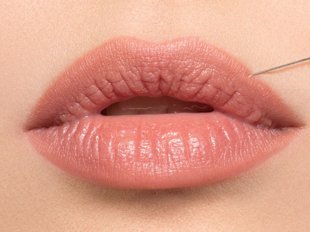 Relleno de labios